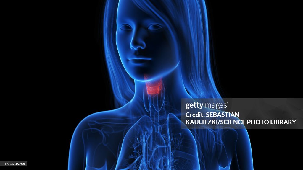 Inflamed thyroid gland, illustration