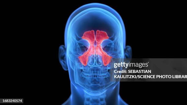stockillustraties, clipart, cartoons en iconen met inflamed sinuses, illustration - sinusitis