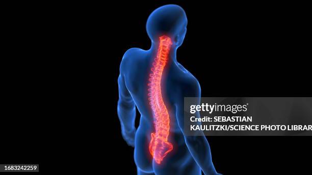 painful spine, illustration - vertebrae stock illustrations