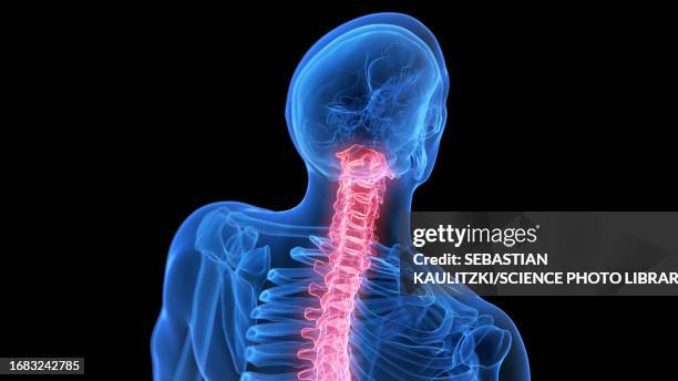 painful upper spine, illustration - upper back pain stock illustrations