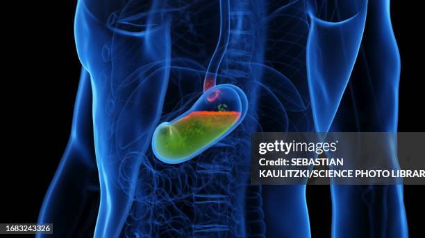 illustrazioni stock, clip art, cartoni animati e icone di tendenza di gastroesophageal reflux disease, illustration - acido