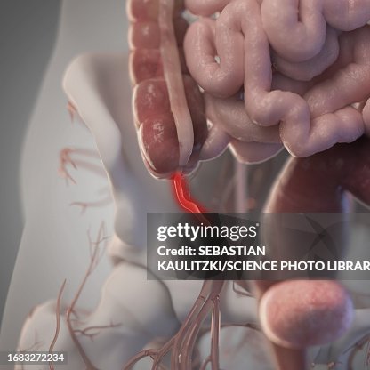 Labelled Appendix Graphic Appendix Illustration High-Res Vector Graphic - Getty Images