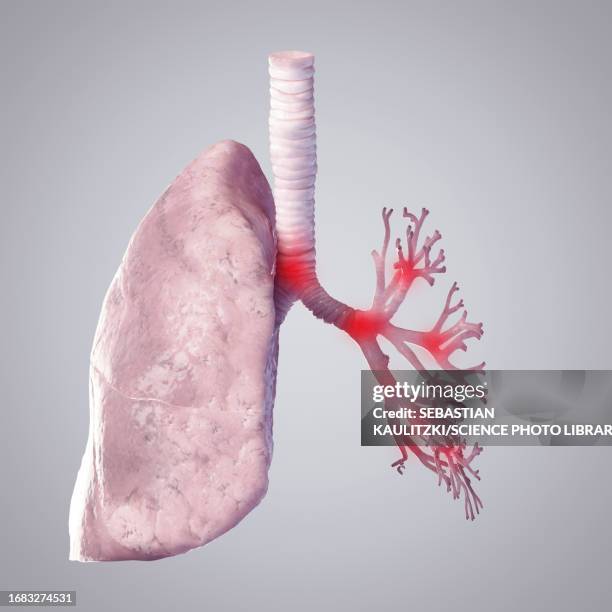 1,283 Bronchiole Anatomy Stock Photos, High-Res Pictures, and Images ...