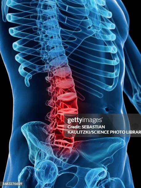 Lower Back 425 Lower Back Anatomy Images Stock Photos, High-Res Pictures, and ...