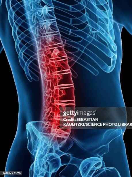 Lower Back 425 Lower Back Anatomy Images Stock Photos, High-Res Pictures, and ...