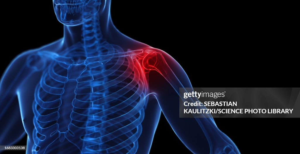 Male shoulder, illustration