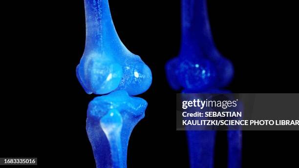 knee joint, illustration - leg bone stock illustrations