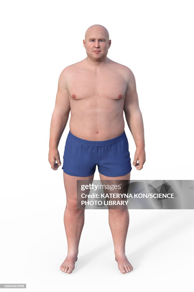 Male Endomorph Body Type Illustration High-Res Vector Graphic - Getty ...