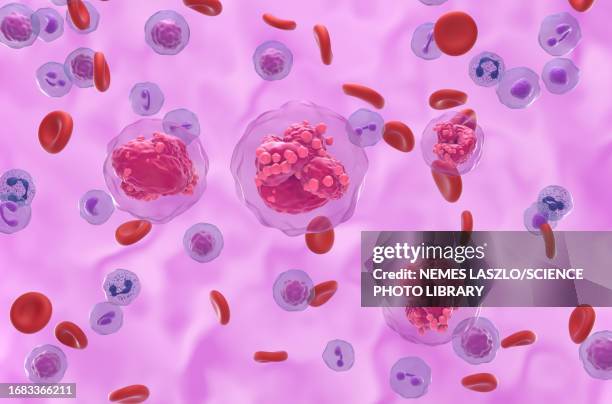 acute lymphoblastic leukemia, illustration - bone marrow stem cell stock illustrations