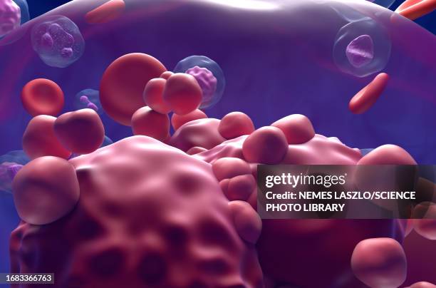 acute lymphoblastic leukemia, illustration - bone marrow stem cell stock illustrations