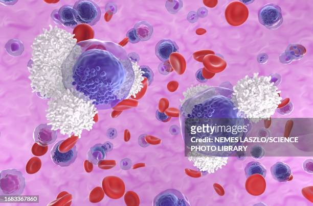 t cell attacking leukemia cell, illustration - lymphoma 幅插畫檔、美工圖案、卡通及圖標