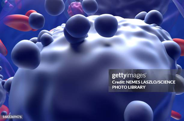 acute myeloid leukemia, illustration - lymphoma 幅插畫檔、美工圖案、卡通及圖標