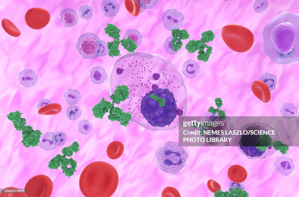 Multiple myeloma cell emitting paraprotein, illustration