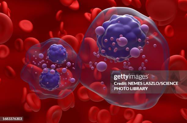 multiple myeloma, illustration - bone marrow stock illustrations