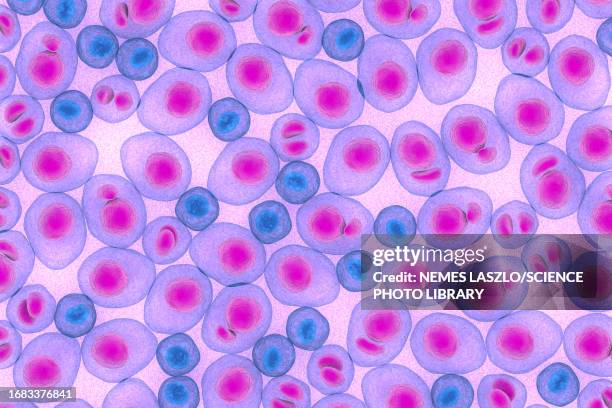 multiple myeloma, illustration - myeloma stock illustrations