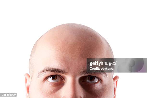 bald head - hair loss stock pictures, royalty-free photos & images