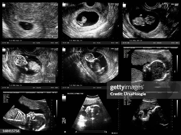 pregnancy ultrasound - human embryo stock pictures, royalty-free photos & images