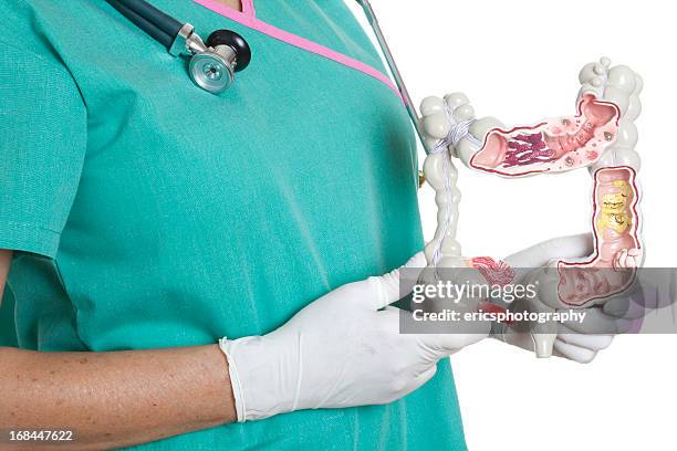 large intestine - bowel cancer stock pictures, royalty-free photos & images