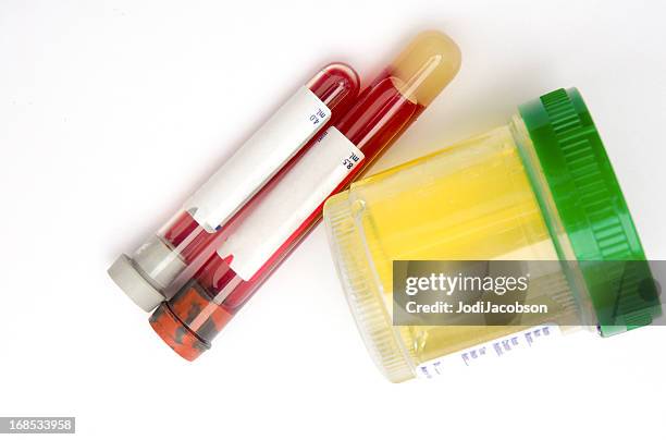 médico: sterile amostra de urina e exame de sangue - medical sample - fotografias e filmes do acervo