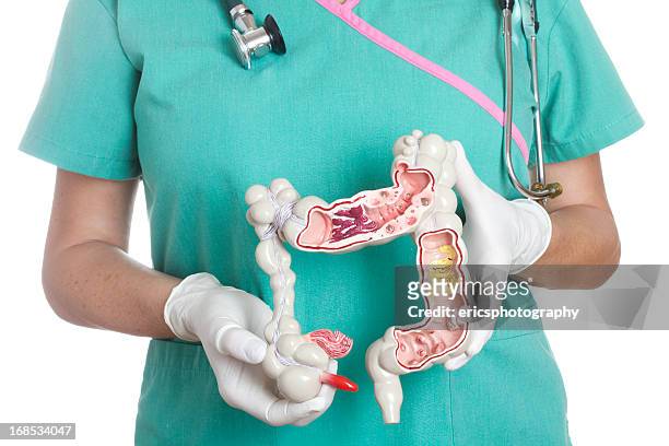 colon - appendicitis 個照片及圖片檔