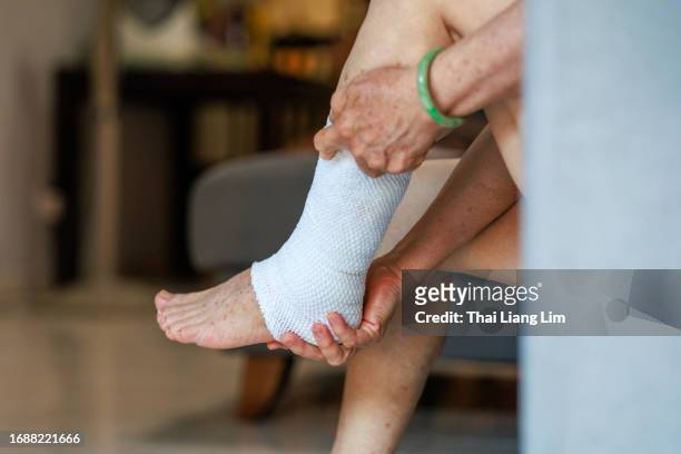 close-up of a senior woman's leg with bandage to protect a sprained ankle and swollen foot - old lady feet 個照片及圖片檔
