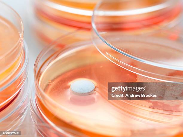 antibiotic drugs being tested to see how resistant they are to bacteria - mrsa infection stock pictures, royalty-free photos & images