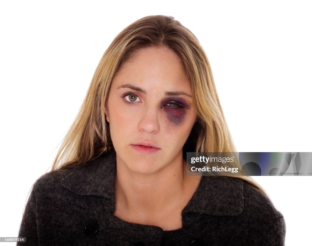 Woman with a Black Eye