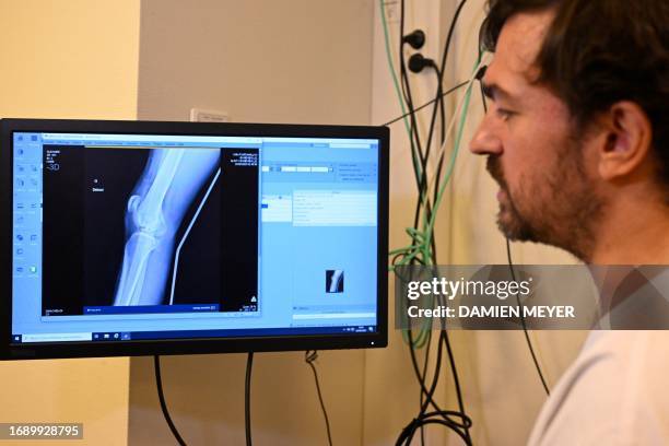 Doctor looks at an x-ray on a screen, helped by artificial intelligence for medical imaging which indicates possible bone fractures and dislocations...