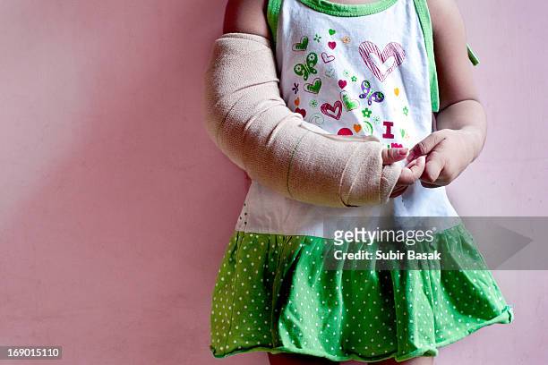 a girl with broken arm - bengali girl stock-fotos und bilder