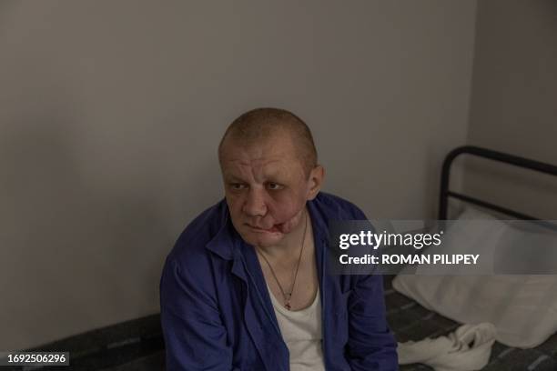 Arthur, an injured Russian prisoner of war sits on a bed at a camp for Russian POWs in western Ukraine on September 19 amid the Russian invasion of...