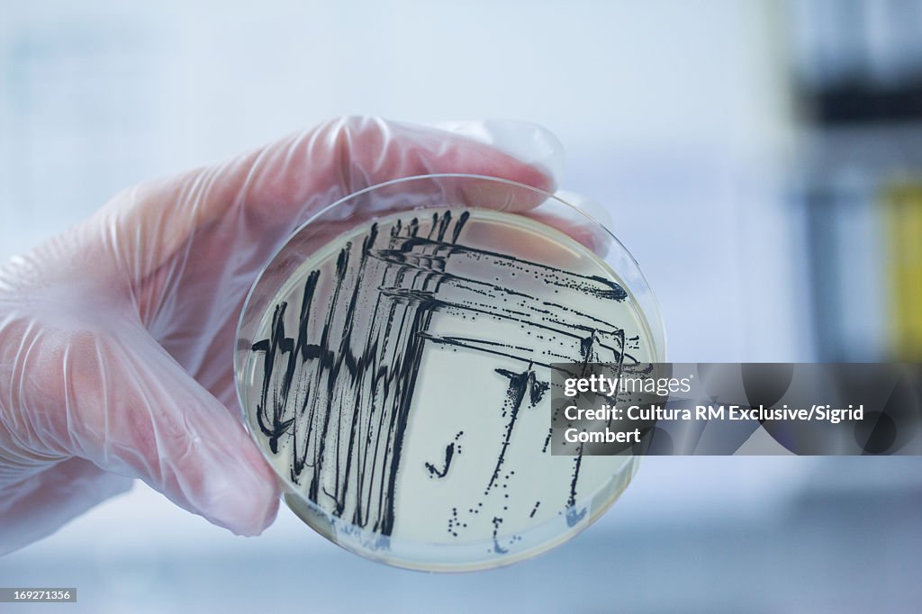 Bacteria growing in petri dish in lab