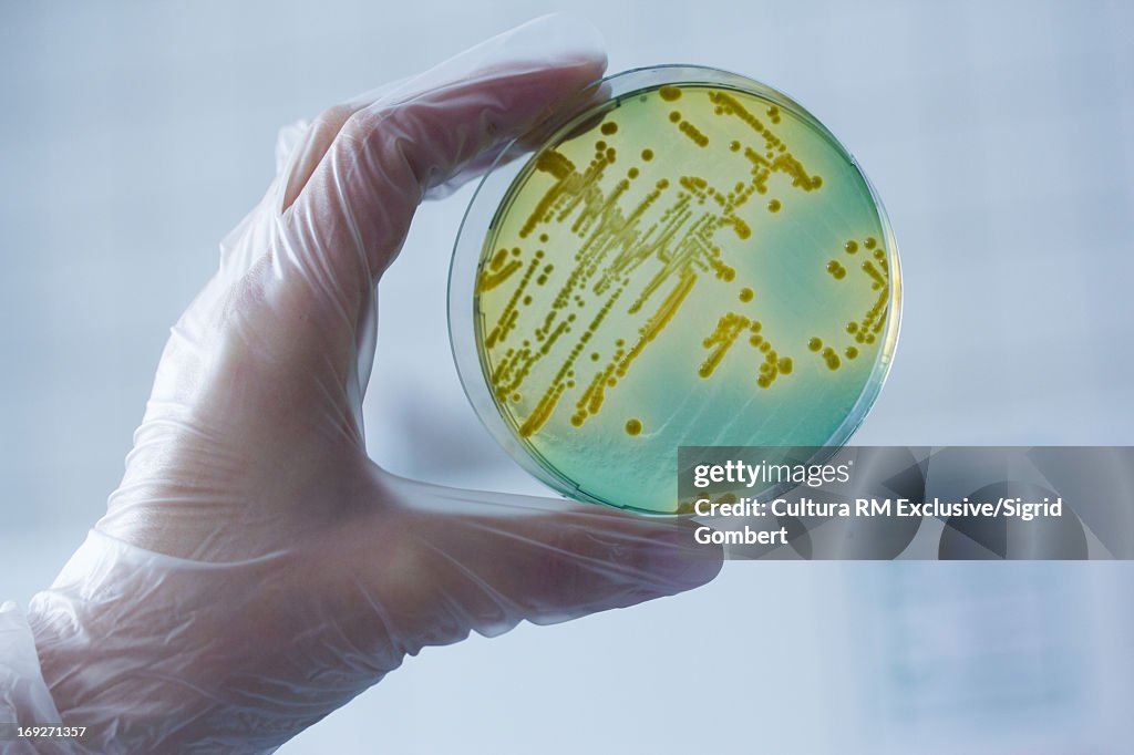 Bacteria growing in petri dish in lab