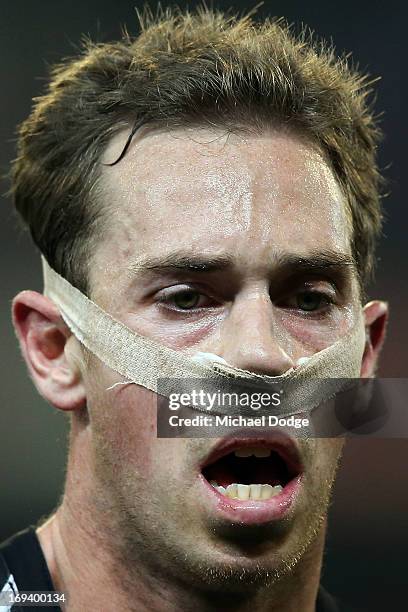 Nick Maxwell of the Magpies with his nose taped up during the round nine AFL match between the Collingwood Magpies and the Sydney Swans at Melbourne...