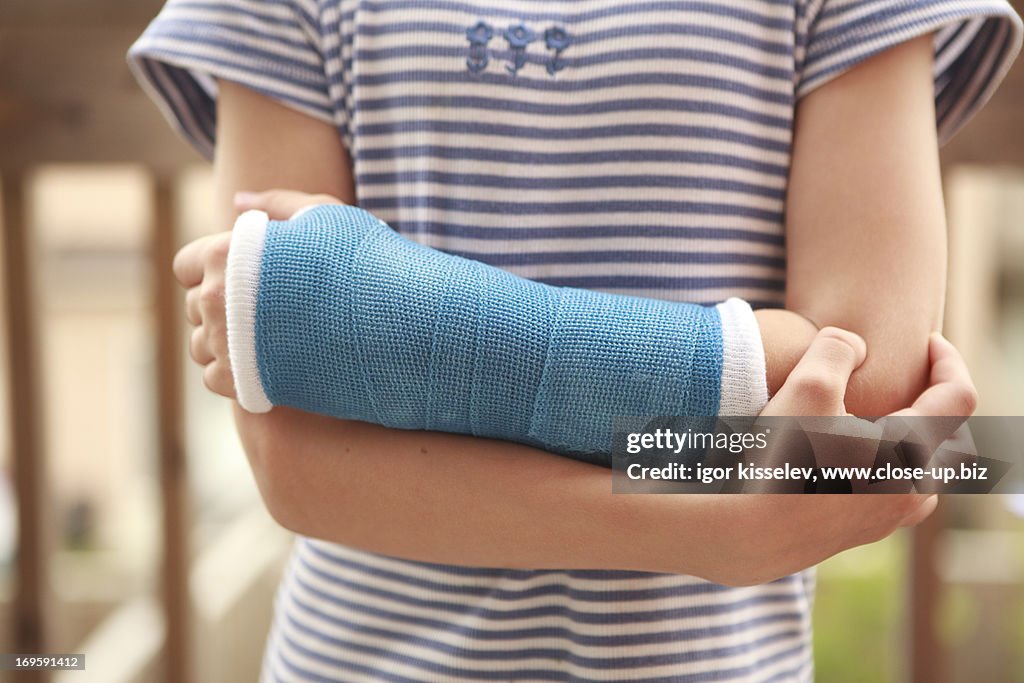 Child arm with a cast