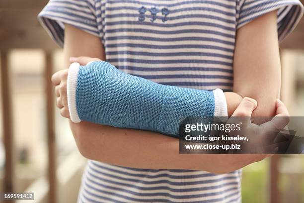 child arm with a cast - close up of arm in cast stock-fotos und bilder