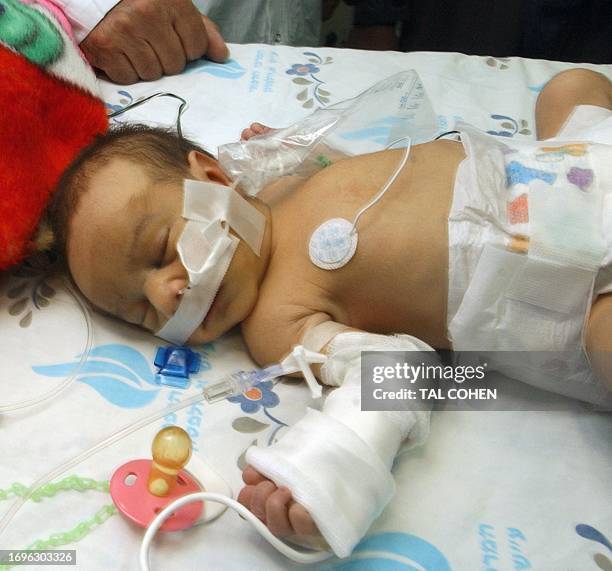 One-week-old Iraqi girl Bayan Jassem from the northern city of Kirkuk, lies in bed at the Wolfson Medicl Center in Holon, south of Tel Aviv, 25...