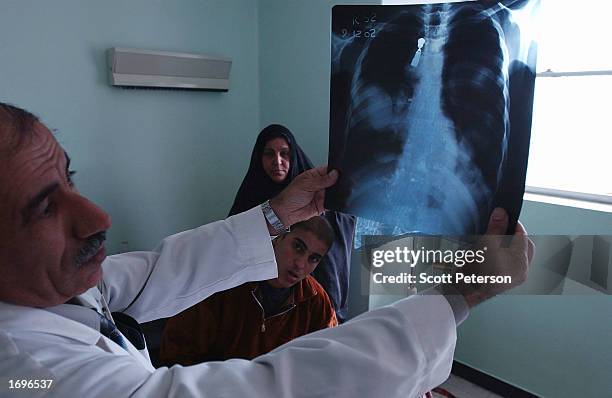 Iraqi cancer specialist Dr. Jawad Kudhim al-Ali examines the X-ray of Ahad Abbas who has bone cancer on his leg, and lung cancer, December 15, 2002...