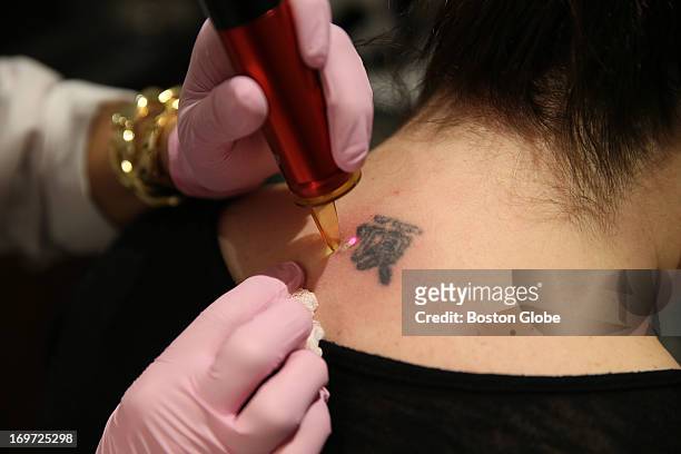 192 Laser Tattoo Removal Photos and Premium High Res Pictures - Getty Images