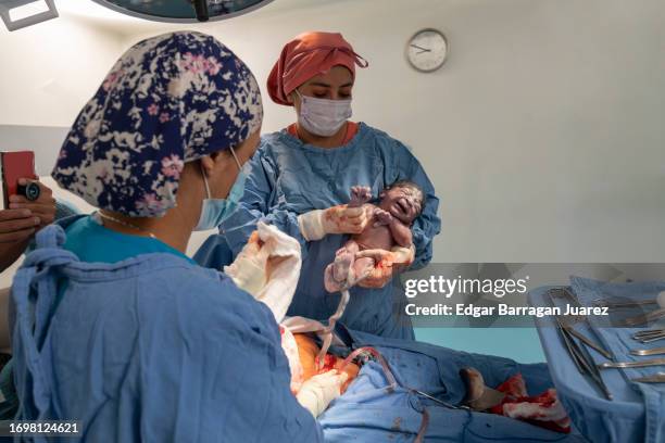 doctor holds baby after performing cesarean section in operating room - baby 3 months stock-fotos und bilder