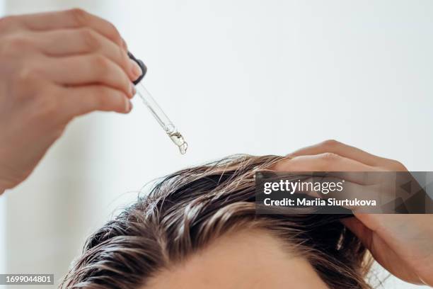 woman applies oil to her hair with pipette. beauty caring for scalp and hair. - caspa - fotografias e filmes do acervo