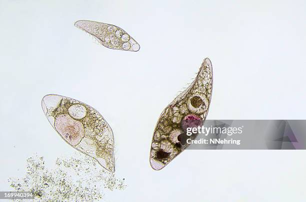 ciliate, blepharisma americanum, micrograph - protozoan stock pictures, royalty-free photos & images