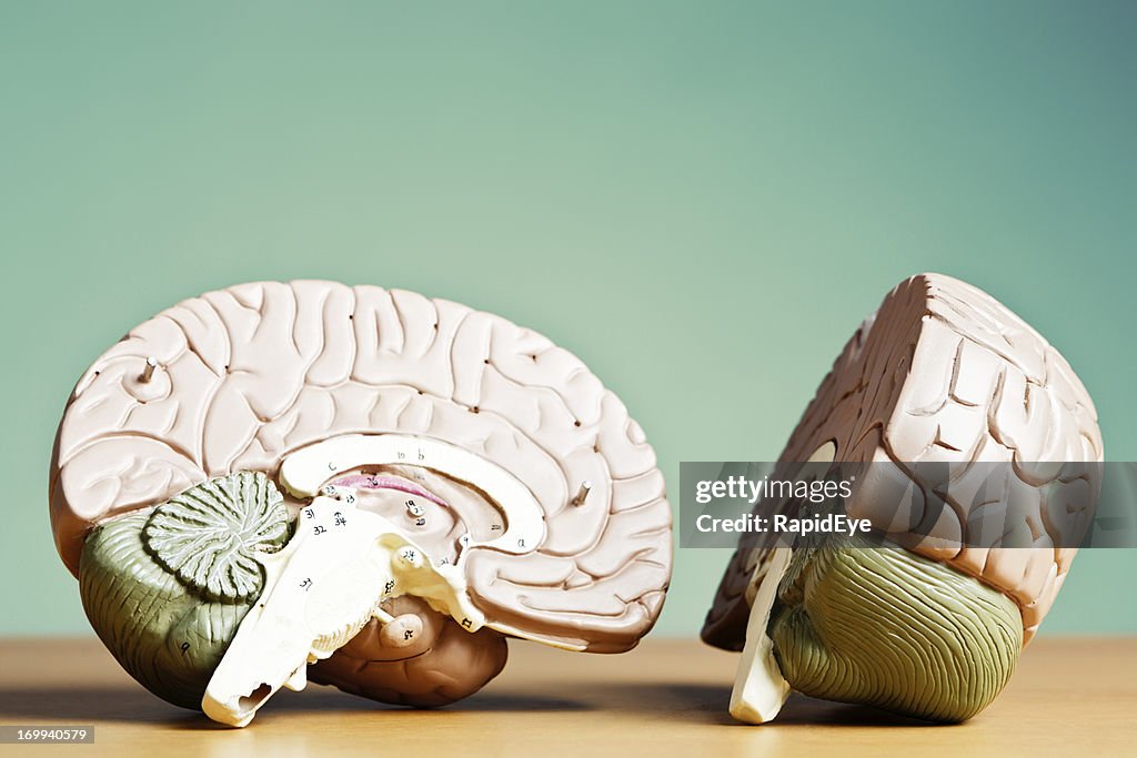 Mind Splitting Whats On Your Mind Model Brain Split In Two High-Res Stock Photo ...