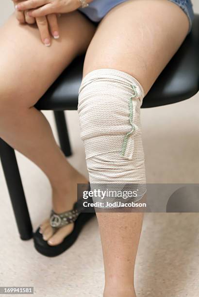 medical: bandaged knee in doctors office - ace bandage stock pictures, royalty-free photos & images