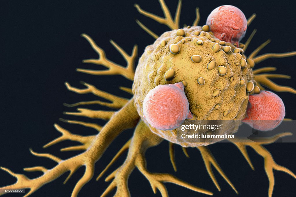 T Lymphocytes and Cancer Cell