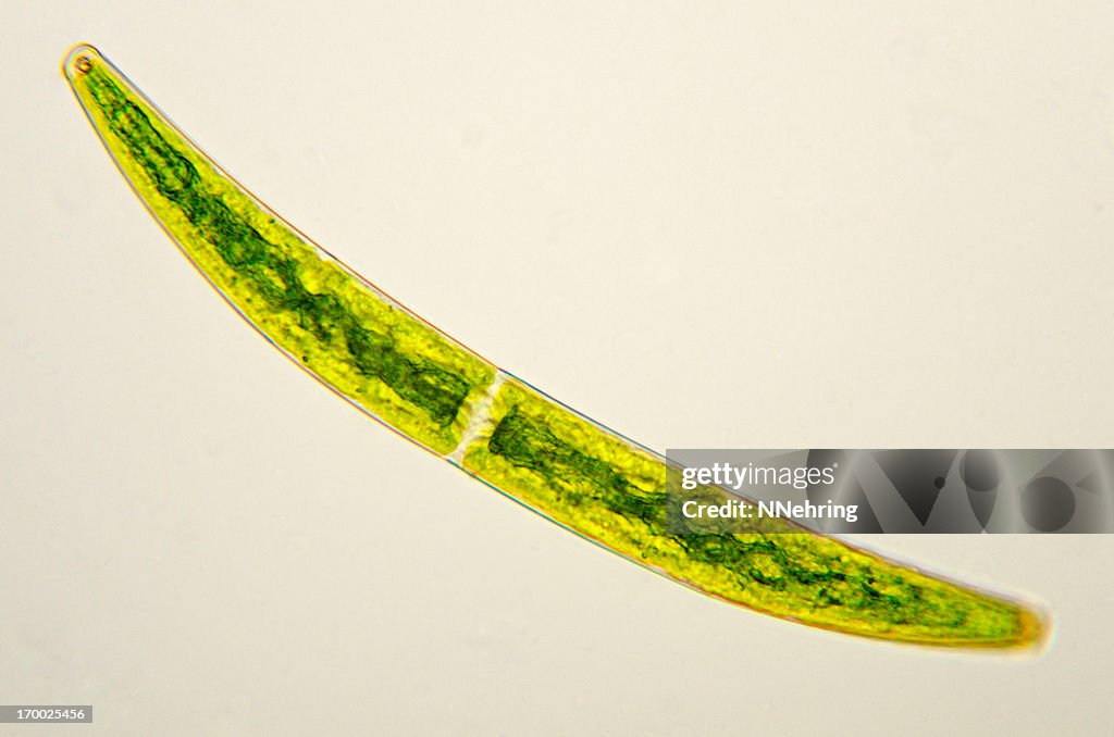 Closterium species desmid micrograph