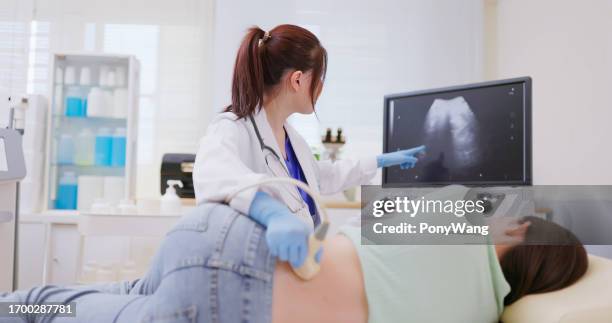 woman kidney ultrasound examination - blaas urinewegstelsel stockfoto's en -beelden