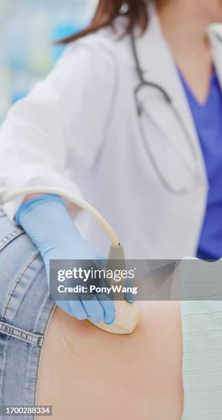 woman kidney ultrasound examination - urologist stock pictures, royalty-free photos & images