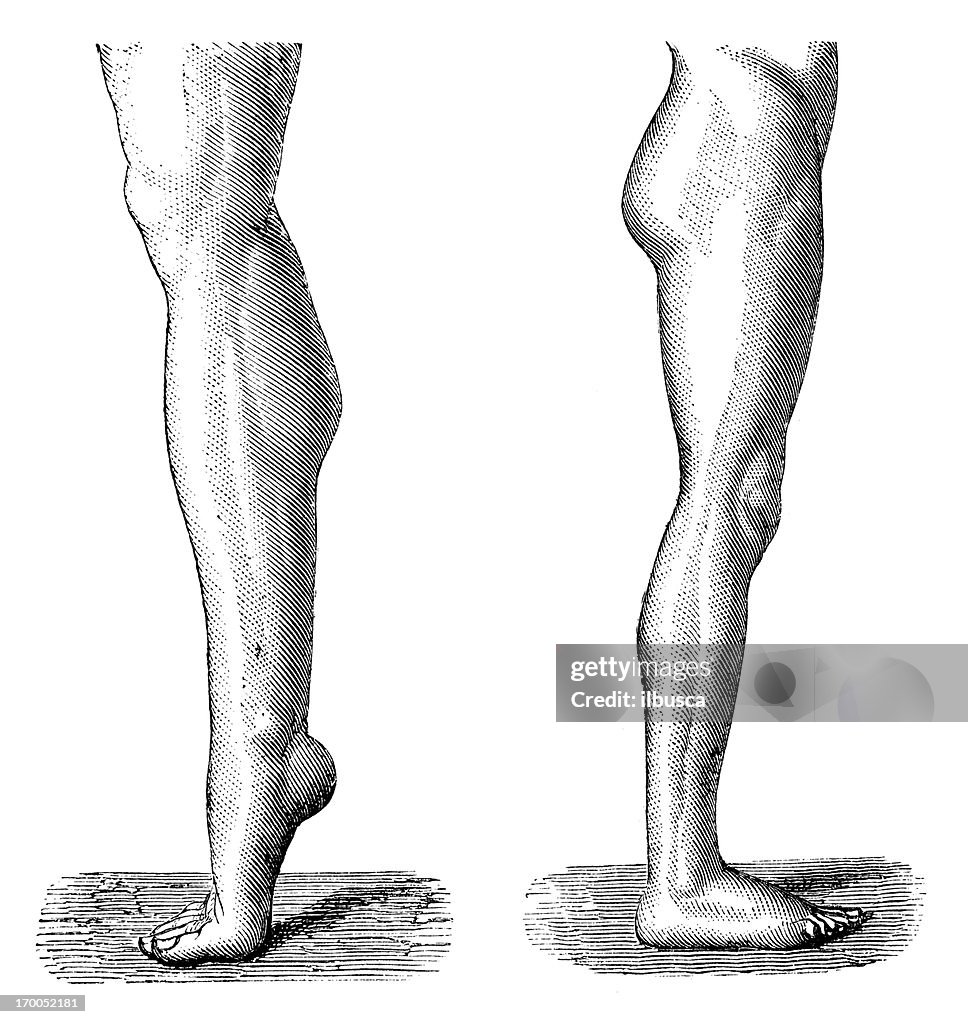 Antique medical scientific illustration high-resolution: legs
