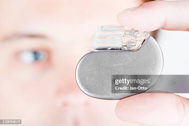 195 Pacemaker Technology Stock Photos, High-Res Pictures, and Images ...