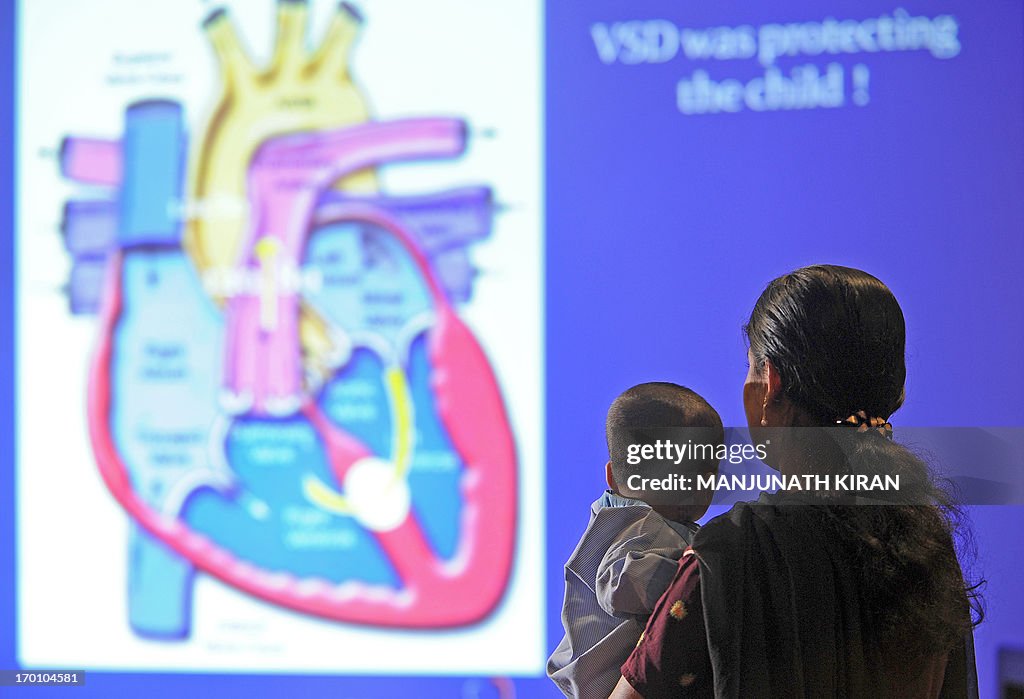 INDIA-HEALTH-HEART-ASCAPA